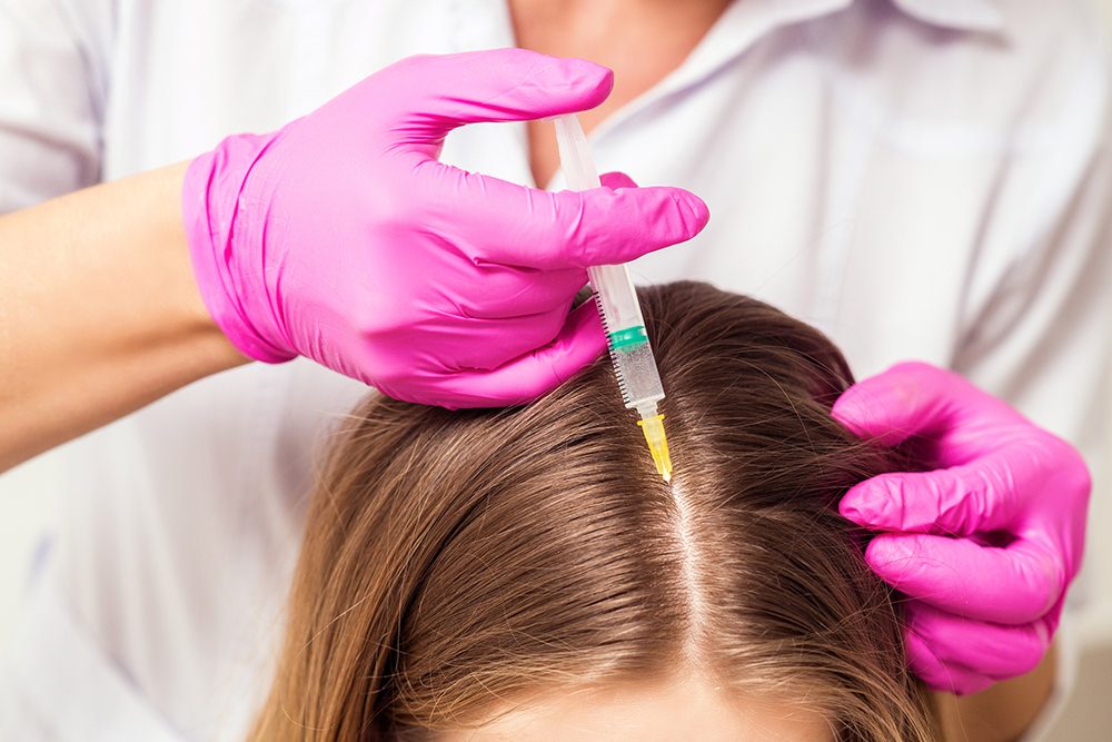 Mesohair Hautarzt Neuss Mesohair